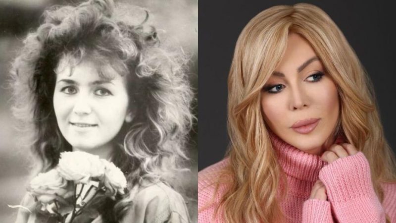 Ірина Білик до та після пластики: який вигляд співачка мала до зміни зовнішності