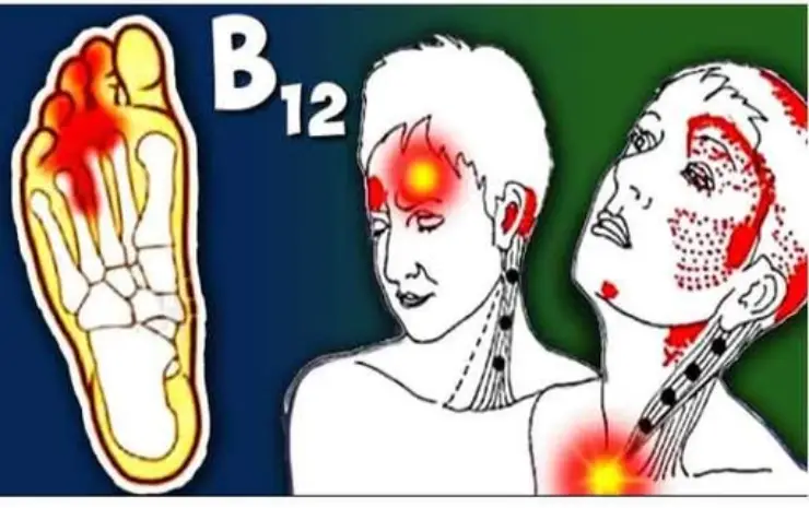 Симптоми нестачі вітаміну B12: сигнали, які не можна ігнорувати