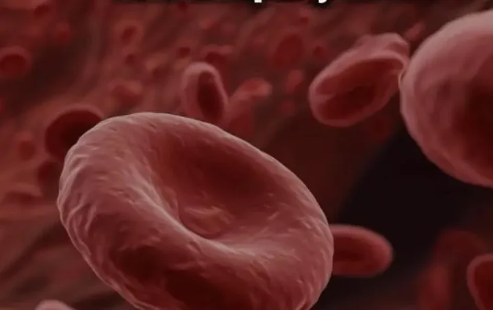 5 справжніх причин високого холестерину, про які майже ніхто нормально не пояснює