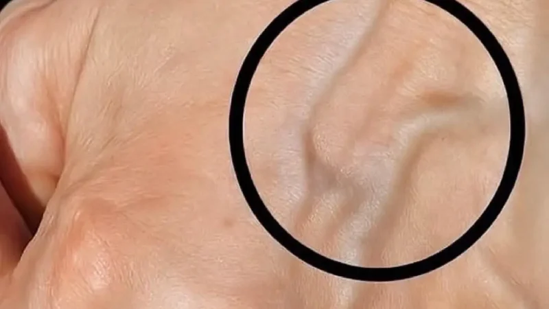 Що означає, якщо у вас випирають вени на руках