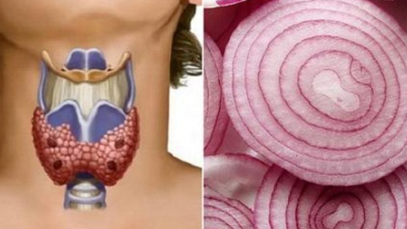 Червона цибуля може творити чудеса для щитовидної залози – ось як її використовувати