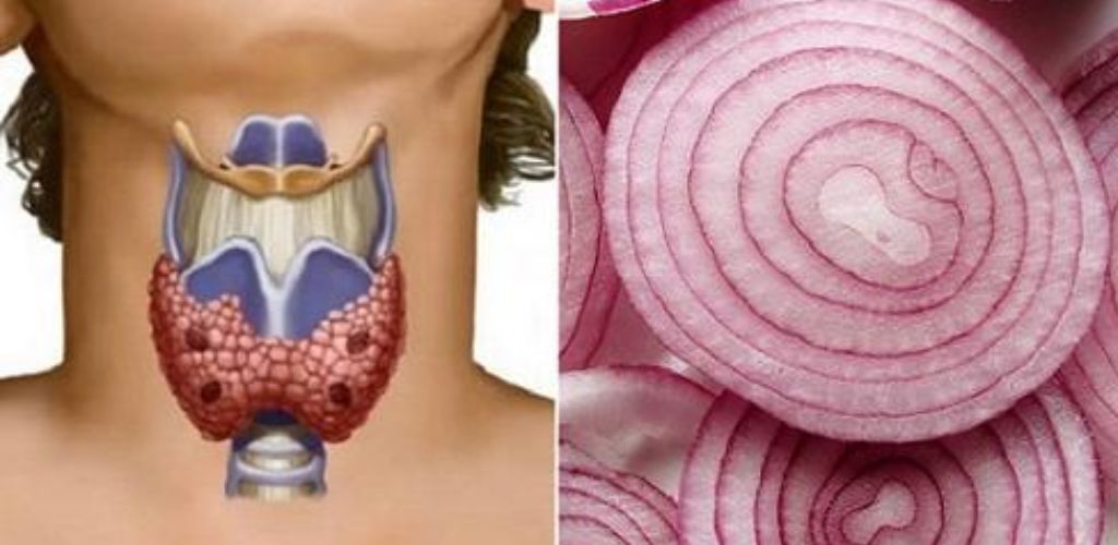 Червона цибуля може творити чудеса для щитовидної залози – ось як її використовувати