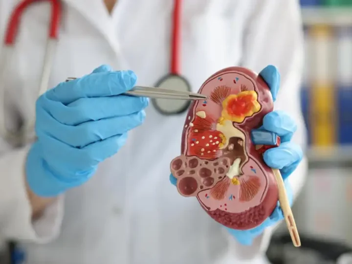 Очищення нирок, печінки та легень природним способом — найкращі методи детоксу для здоров’я