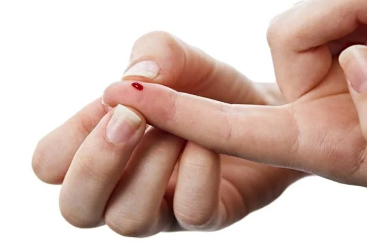 Як голка може врятувати вас під час інсульту