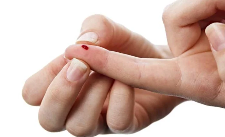 Як голка може врятувати вас під час інсульту