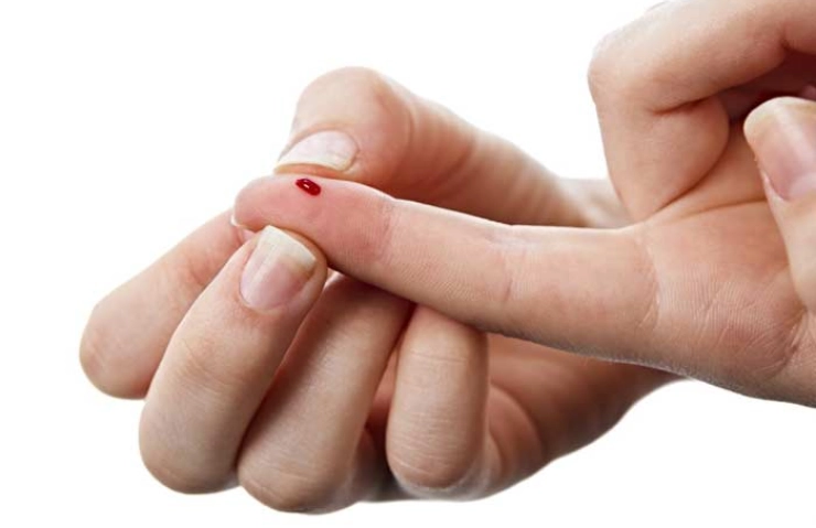 Як голка може врятувати вас під час інсульту