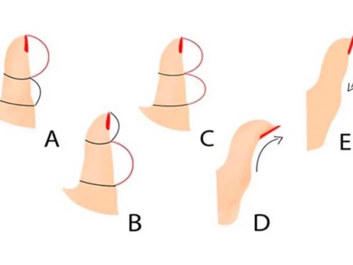 Великий палець вашої правої руки може розповісти про вас усе