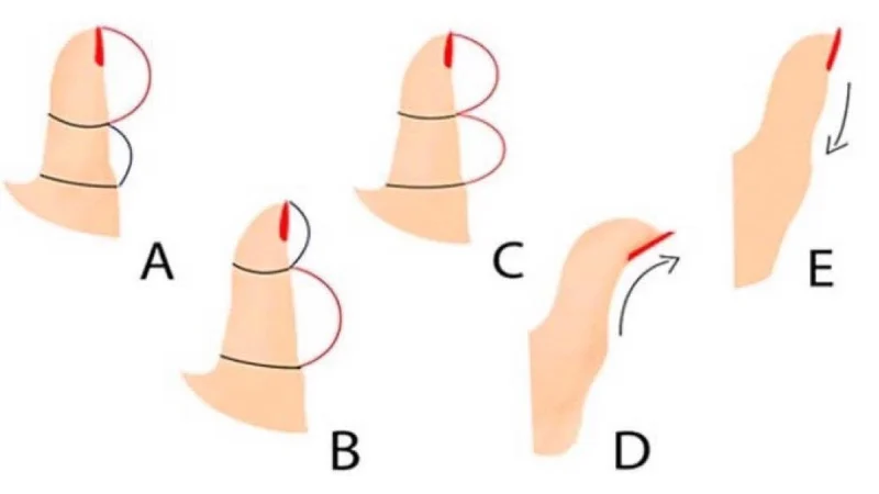Великий палець вашої правої руки може розповісти про вас усе